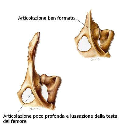 articolazione displasia dell'anca articolazione displasia dell'anca